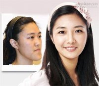 Bí quyết trang điểm cho mặt thon, cằm nhọn