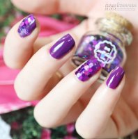 Nail kim tuyến cỡ lớn đẹp hơn