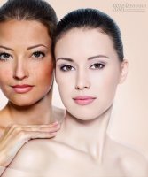 Không còn lo lắng nám da nhờ giá đỗ