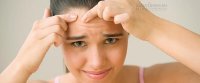 Bí quyết trị mụn trứng cá