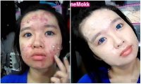 Cô gái trang điểm che mụn rùng rợn khiến bác sĩ hết hồn