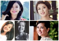 Ngắm 'mỹ nhân' Huyền My, Hồng Nhung... đổi diện mạo nhờ nhổ răng khểnh