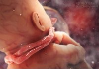 Mẹo hay để thai nhi tự tháo tràng hoa quấn cổ