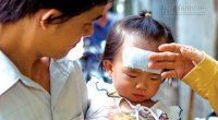 Nguy hiểm khôn lường khi sử dụng miếng dán hạ sốt sai cách
