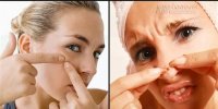 Những cách trị mụn bọc cực hiệu quả mà giá rẻ bất ngờ