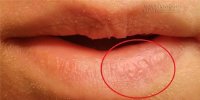 Những lý do không ngờ khiến môi bạn luôn khô và nứt nẻ