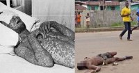 10 Căn bệnh nguy hiểm đáng sợ nhất lịch sử nhân loại