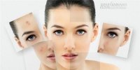 Những thành phần bạn không nên sử dụng cho da mặt