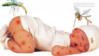 Mẹo hay để xử lý khi muỗi cắn rất hiệu quả