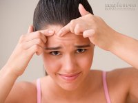 Bí quyết sạch mụn tại nhà trong 5 buổi tối