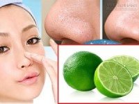 Tuyệt chiêu đánh bay mụn đầu đen tại nhà bạn nên thử ngay