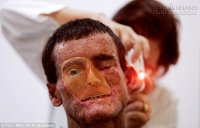 Kỳ lạ căn bệnh bí hiểm khiến cả thị trấn sợ ánh mặt trời