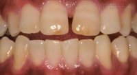 Báo động đỏ căn bệnh mà 90% người Việt đang mắc phải