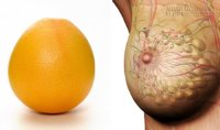 10 Loại quả ăn gì bổ nấy để mẹ bầu khỏe toàn diện