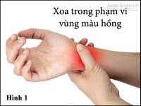 Chữa chảy mũi, nghẹt mũi, ho... không cần dùng thuốc