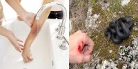 Những cách sơ cứu đơn giản mà bạn nên thuộc-nằm-lòng