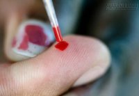 Mẹo xử lý khi không may có nguy cơ bị phơi nhiễm HIV
