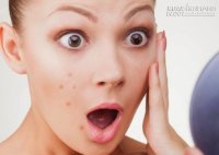 5 sai lầm khi trang điểm khiến mụn lên chi chít