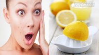 Những sai lầm khi làm đẹp với chanh khiến làn da bạn xấu tệ hại