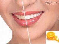 Răng trắng trong tíc tắc chỉ bằng vỏ cam chanh