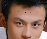 Những nốt ruồi đại phú đại quý trên cơ thể đàn ông