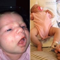 Tác hại chết người của thói quen hôn trẻ sơ sinh