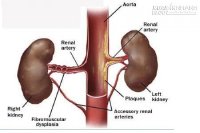 Mỗi ngày, chỉ cần làm việc này 2 lần là ... suy thận