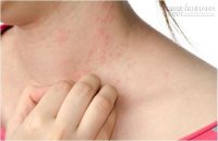 Có dấu hiệu sau rất có thể bạn đã mắc ung thư gan giai đoạn đầu