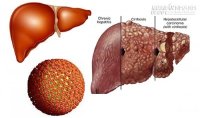 Cảnh báo: những loại bệnh càng để lâu dễ thành ung thư