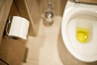Sự thật khủng khiếp về màu nước tiểu có thể bạn chưa biết