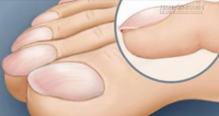 Nếu có những biểu hiệu sau, hay tới bệnh viện chuyên khoa Gan ngay lập tức
