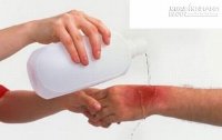 Nằm lòng những cách xử lí khi bị kiến ba khoang tấn công