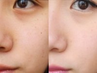 Những mẹo thu nhỏ lỗ chân lông hiệu quả hơn cả mỹ phẩm đắt tiền
