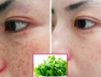 Da trắng hồng, hết nám sạm nhờ 2 loại rau ngày nào cũng ăn