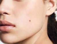 Nữ giới kỵ nốt ruồi ở vị trí nào?
