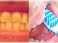 5 thói quen lười biếng âm thầm phá hỏng hàm răng