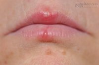 10 Hậu quả ghê rợn của việc cắn móng tay ít ai ngờ tới