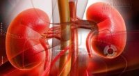 Có triệu chứng sau không khám ngay coi chừng cả đời chạy thận