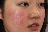 Những hậu quả khôn lường khi lạm dụng make up