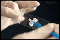 Là phụ nữ cần làm những xét nghiệm gì?