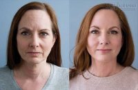 Mất 10 phút mỗi ngày nhưng trẻ hơn 10 năm chị em ạ