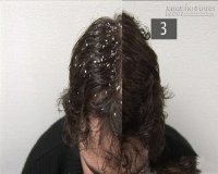 Sạch gàu ngay lần đầu tiên sử dụng nguyên liệu tự nhiên này