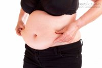 Đốt mỡ bụng: muốn hiệu quả chị em đừng bao giờ phạm 3 điều sau