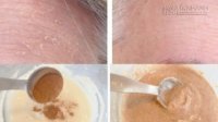 Loại bỏ ngay nếp nhăn trên khuôn mặt ngay trong lần đầu sử dụng