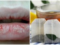 Tuyệt chiêu giúp đôi môi không bị khô nẻ ngay cả khi không dùng son dưỡng