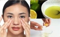 Trị mụn, trị nám, trắng da 3 trong 1 với trứng gà
