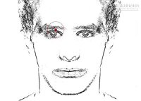 Điềm báo xui xẻo từ những nốt ruồi xuất hiện bất ngờ