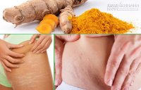 Giải quyết tất tần tật các vấn đề về da sau sinh