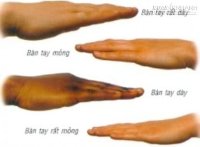 Độ dày mỏng của bàn tay