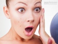 4 sai lầm khiến bạn dưỡng da không những không trắng mà còn nổi mụn